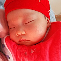 宝宝浮皮是什么原因？热疹什么时候会消呢