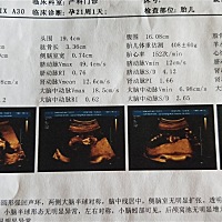 谁能看的懂，帮忙看看是男孩女孩，一胎是儿子二胎想要闺女🙏