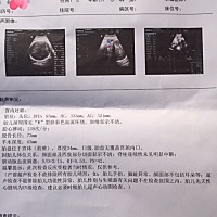 37周彩超单，会看男女的帮忙看一下😄