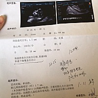 宝妈们帮我看下，报告单，第一个是本地市医院检查的，第二个是当天去别家医院检查的，第二次做了两次，...