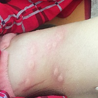 这是怎么回事啊？身上好多