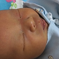 宝宝眼睛总出黄水 还伴有眼屎出来 感觉不怎么爱睁眼睛 粘住了似的 请问这是怎么了