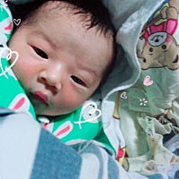 今天第二天医生说宝宝黄疸 好担心怎么会这样子