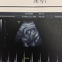 请问是男是女呢，谁告诉我🙏拜托