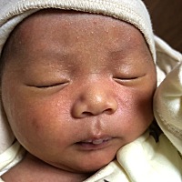 各位宝妈，我家宝贝生下来第三天发现右侧脸上有个这个小青色，有宝妈知道什么原因吗？现在都22天了，会...