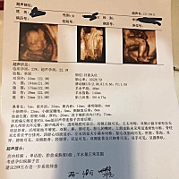 谁帮我看一下我宝宝有没有问题？还有就是谁帮我看看是姑娘还是小子。谢谢你们。