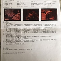 请问朋友们，三级超声检查就是四维吗？我感觉这家医院好像没有要给我做四维的意思，好像没有这个项目…...