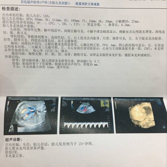 三维彩超顺利通过！有会看男女的宝妈吗？