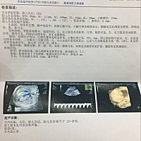 三维彩超顺利通过 三维彩超顺利通过！有会看男女的宝妈吗？