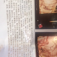 亲们都帮我看看，都说像女宝，到底是男宝还是女宝呢