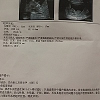 玻璃心的妈妈伤不起啊，提心吊胆的每一天，谢天谢地，NT终于过了！