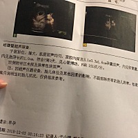 七周的时候做B超 胎心 胎芽都有了，现在9周多一点 需要再去做B超吗？还是等着NT一起做，给点建议 宝妈们