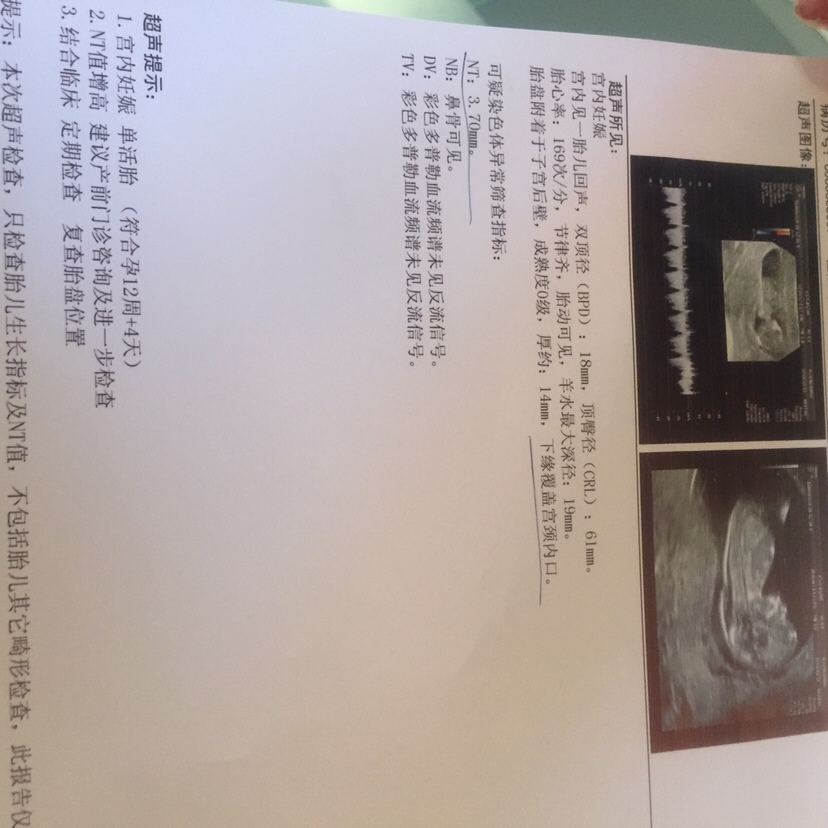 有没有NT值高3.7，羊穿很正常的，生下来宝宝很健康的，看到这个泪流满面。