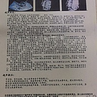 四位彩超过了。但是可能胎盘植入，医生建议1个月后再拍一次。有看的懂的吗？