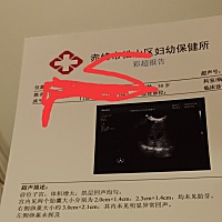 宝贝们，咱们一起努力好嘛，你们你们努力健康成长。我怎么都愿意，期待十天后，你们胎芽胎心都一次过。