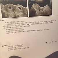 什么情况……医生建议两周后复查，好吓人，现在能看出来男女吗