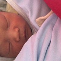 刚出生的宝宝眉毛上有个硬包，周围是白色的，中间是透明的，摸上去是硬的，也不痛不痒，医生说过几个月...