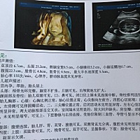 有点好奇，是男孩还是女孩。