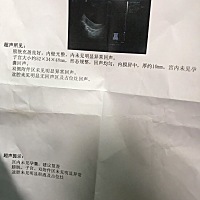 哭哭，50天了还是什么都看不到啊，折磨死了