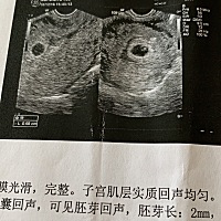 怀孕6周，听说B超单形状可以看出男女准吗？我想问问你们我的是圆形，听说茄子🍆长形就是男孩，圆或椭...
