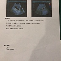 有没有有经验的女同胞帮我看下，我十月份上中旬来的大姨妈，量不是很多，十一月份没来，这个月12号来了...