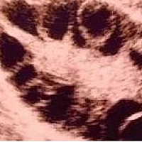 我们首先来了解一下卵子是如何产生的，卵子是由我们通常所说的女性性腺--卵巢产生的。卵子是人体最大的...