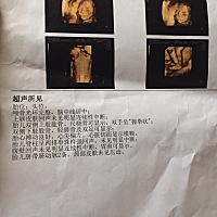 宝宝和做四维时很像，就连表情也像