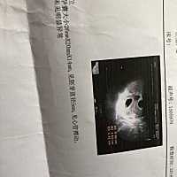 6➕4啦～10月份生化了一个，11月份又怀孕了，现在6➕4啦～有木有会看B超男女的姐妹们呀～
