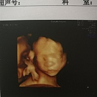 折腾了两天，四维终于过了，刚才忘记发图现在补上