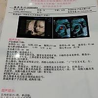 有没有会看男女宝宝的呀！好奇想知道😁😁