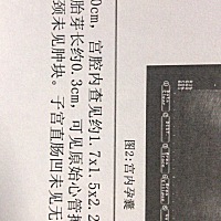 懂的帮我看看 帮我看下男宝还是女宝