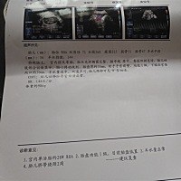 宝宝们帮忙看看，绕颈两周，羊水偏少怎么办？？？