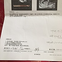 亲们谁懂的帮我看看这个NT，会影响宝宝发育吗？