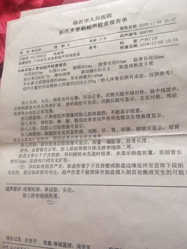 什么胎心看性别，一点也不准，生下来