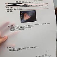 有没有会看的，医生说太小，让我十天后复查，我有点担心。