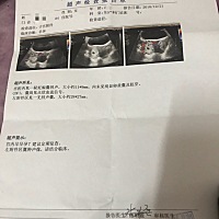 亲们，能帮忙看看我的是什么情况吗？10月21号是最后一次大姨妈，12月12号去照的时候医生说太小，照不到...