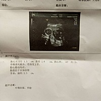 老大男宝，想要一枚小公举，帮忙看看15周