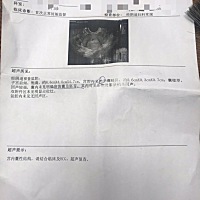 怀孕43天流血。后面抽血hcg翻倍好。孕酮低10点几。昨天第50天，去医院医生让我准备住院。说我是宫外孕。...