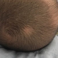 宝宝刚出生头顶就有撮白头发，满月剃头之后新长的头发还是白色的，有没有同样的情况啊？什么原因导致的啊？