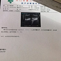 大家快帮我看下！我10月12日停经，月经一直不规律，然后第一次b 超显示宝宝怀孕了5周加3天，在怀孕大概...