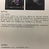 35周➕4天医生说胎儿头骨小？ 这算小吗？好担心！