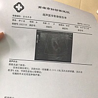 剖腹产三胎，吃啥吐啥，有没有绝招不用孕吐那么辛苦……