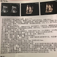 不会看男宝跟女宝，胎心监测140分次，不知道是男宝还是女宝，