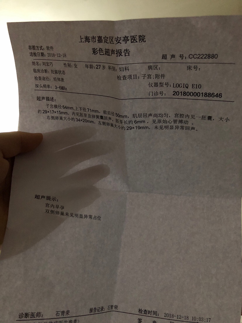 这个小家伙是个意外的惊喜，没有准备，他就来了，有会看的吗，做的b超医生说才7周加2。我下一次什么时候去检查呢？