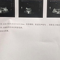 🤰5周➕3天开始 流了已经4天褐色分泌物了 而且做b超 没有孕囊 只有暗区怎么办