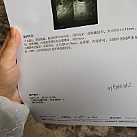 有会看B超单的吗？像男孩还是女孩？