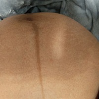 孕晚期各种睡不好感觉肚子已经往下掉了，不知二宝会不会提前发动