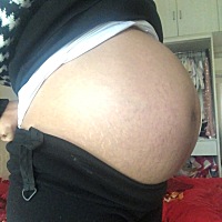 孕34周得了外痔，难受死了！附上一张大肚照！