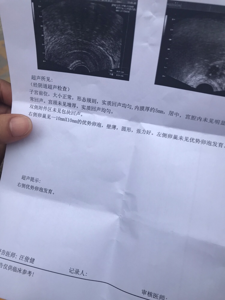 月经十一号 这个是今天检测的 第一次检测卵泡 有懂的吗 医生看了没有说什么 让隔天再去 我朋友刚才说他12天都长到17x10了