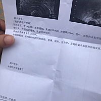 月经十一号 这个是今天检测的 第一次检测卵泡 有懂的吗 医生看了没有说什么 让隔天再去 我朋友刚才说他1...